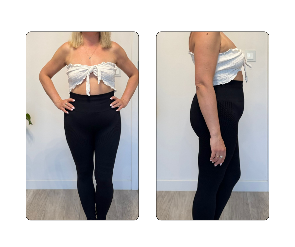 KetoDietetyk - Ewa -13kg w 4 msc ->efekt diety